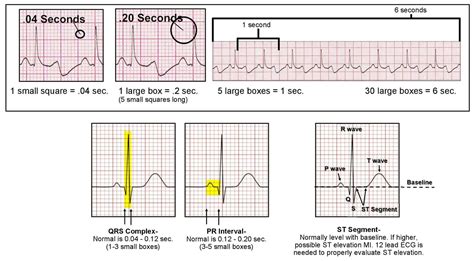 validity of ecg result|Accuracy of Physicians’ Electrocardiogram Interpretations .